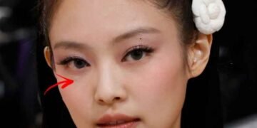 ندبة جيني من بلاك بينك تبدو واضحة في آخر صورة لها : الآراء