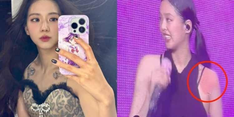 اصابة جيني في الكتف و مرض جيسو و المزيد : البلينك يشعر بالقلق