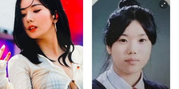 صور كون اونبي قبل الجراحة التجميلية تثير جدلا