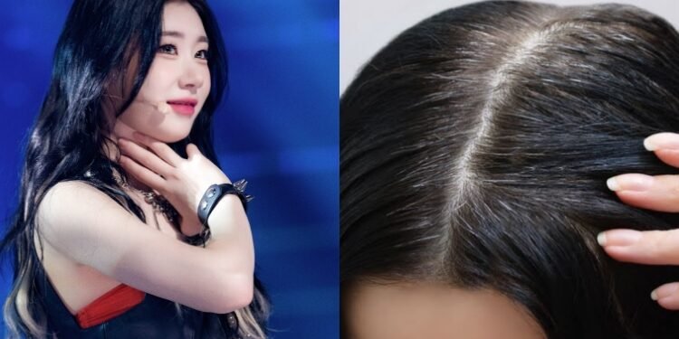 تشايريونغ ( 22 عامًا ) أصبح لديها شعر رمادي ( الشيب ) بالفعل