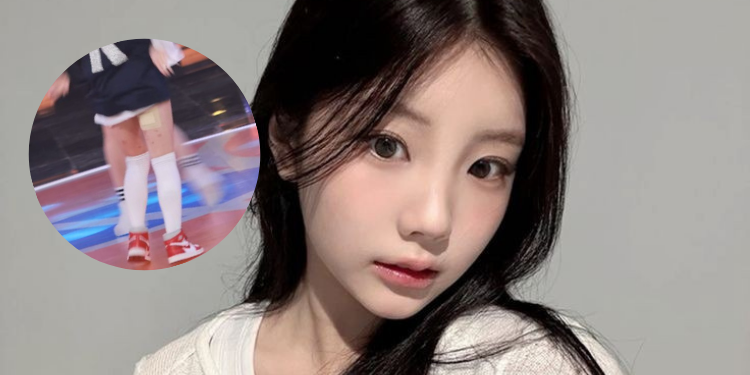 وونهي من ايليت تثير القلق بعد ظهور صور لساقيها مع جرو