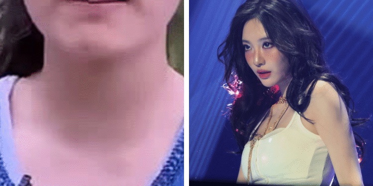 صور نينغ نينغ من ايسبا قبل اجراء عمليات التجميل؟ نقاش الكوريين