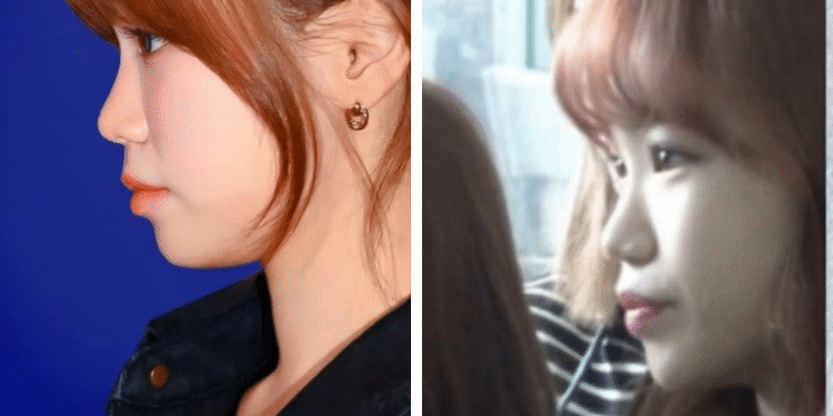 تشايون أجرت عملية تجميلية لـ أنفها؟ نقاش الكوريين