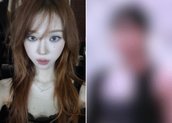 تتعرض وينتر من ايسبا للسخرية بعد ظهور صورها قبل الترسيم