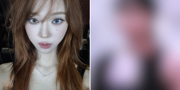 تتعرض وينتر من ايسبا للسخرية بعد ظهور صورها قبل الترسيم