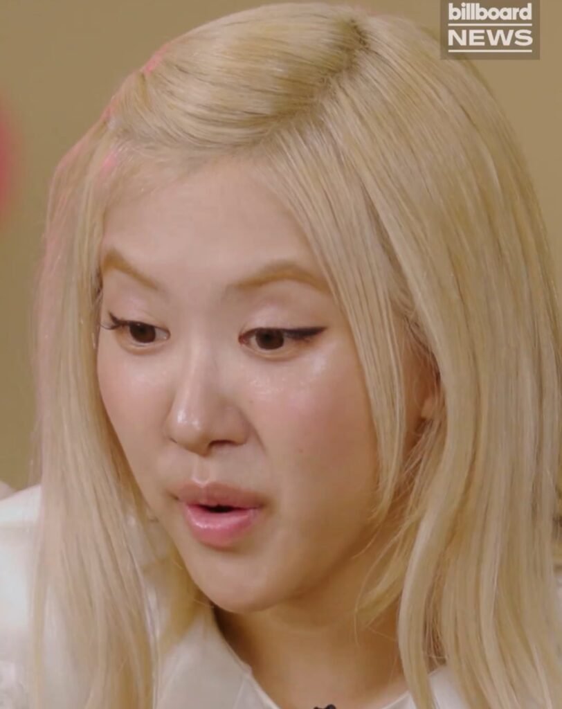 روزي متهمة باستعمال البوتوكس بعد ظهورها الأخير؟ آراء