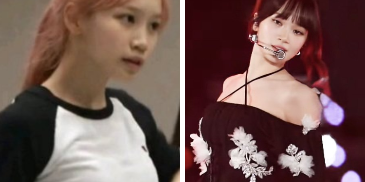 مؤخرا، انتشر منشور على منصة بان الكورية يتحدث عن التغييرات في مظهر كيم تشايون قائدة ليسيرافيم خلال السنوات الماضية ومتهما إياها بإجراء عملية تكبير الثدي.